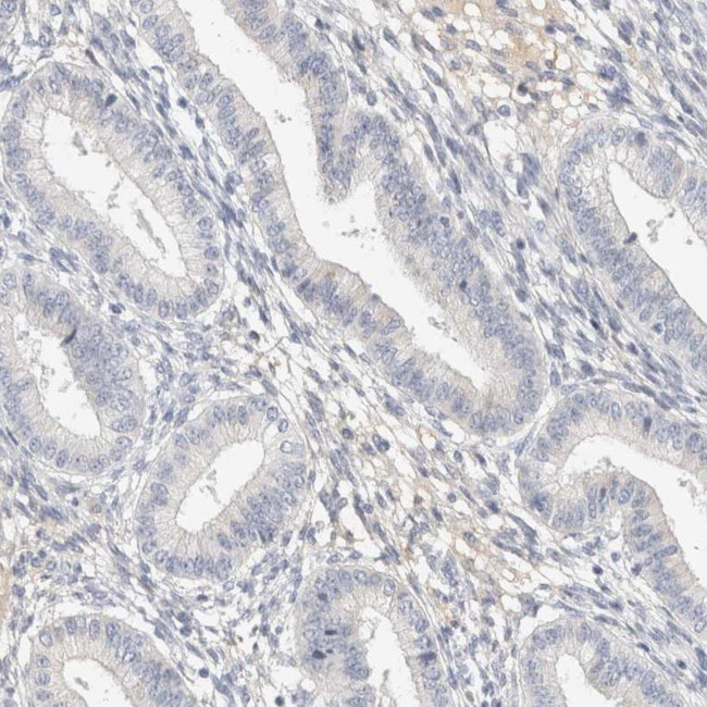 STK31 Antibody in Immunohistochemistry (Paraffin) (IHC (P))