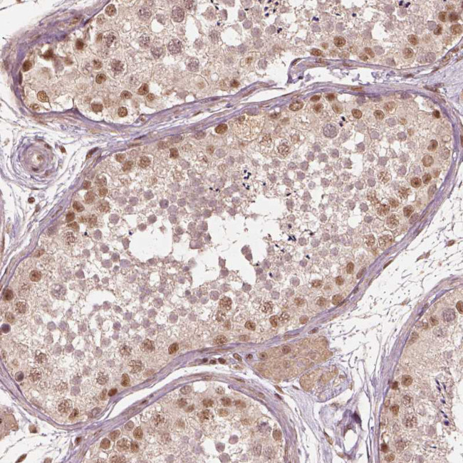 BRD9 Antibody in Immunohistochemistry (Paraffin) (IHC (P))