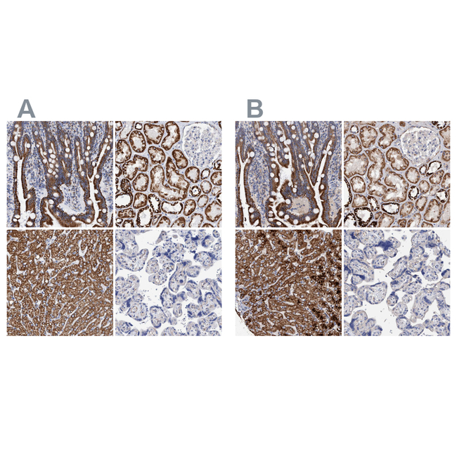 DECR1 Antibody in Immunohistochemistry (Paraffin) (IHC (P))
