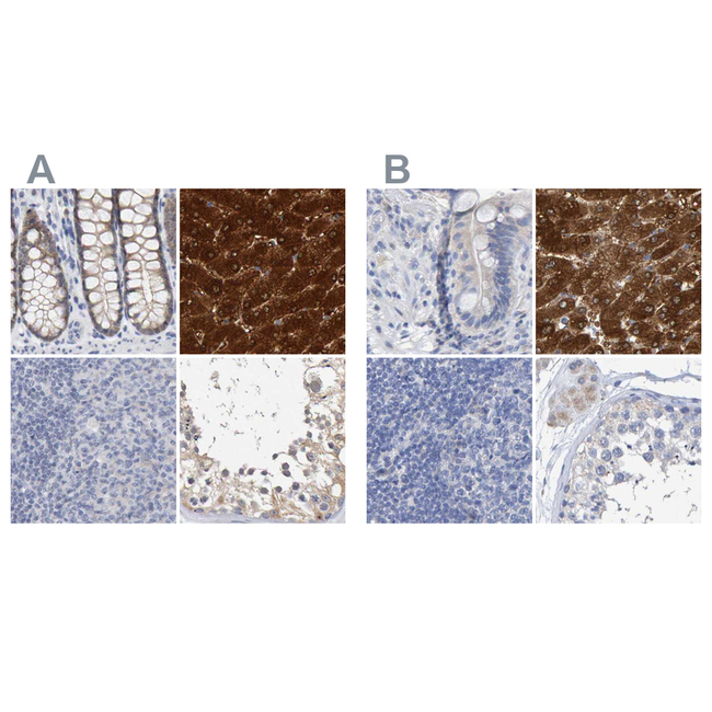 CTH Antibody in Immunohistochemistry (Paraffin) (IHC (P))