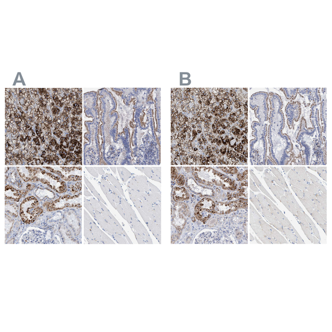 SGSH Antibody in Immunohistochemistry (Paraffin) (IHC (P))