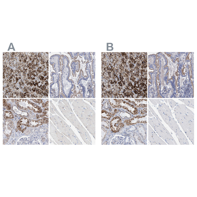 SGSH Antibody in Immunohistochemistry (Paraffin) (IHC (P))