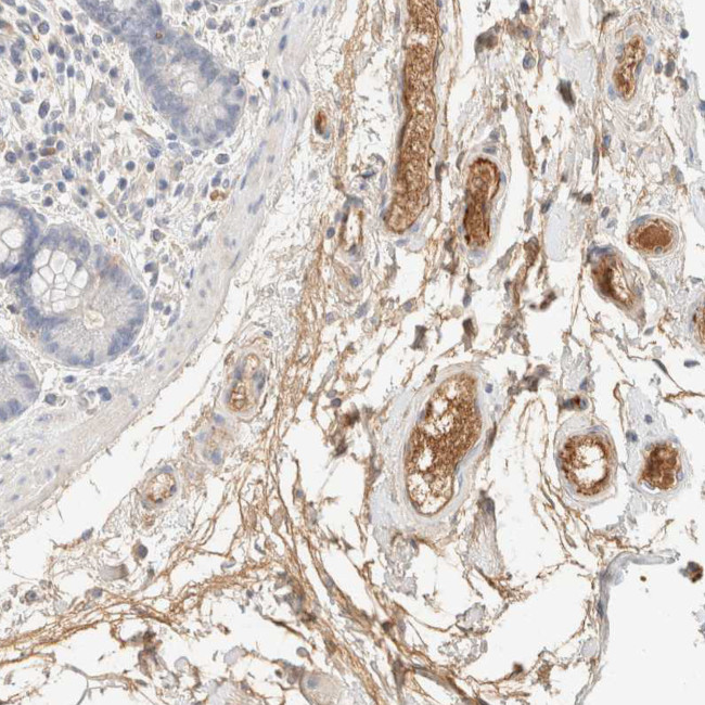 C8B Antibody in Immunohistochemistry (Paraffin) (IHC (P))