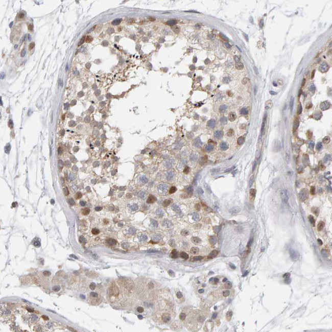MSRA Antibody in Immunohistochemistry (Paraffin) (IHC (P))