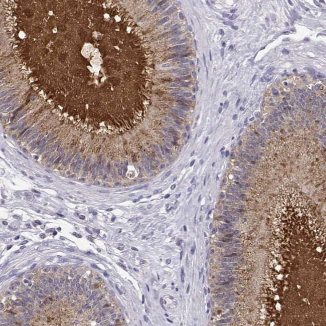 SPAG11B Antibody in Immunohistochemistry (Paraffin) (IHC (P))