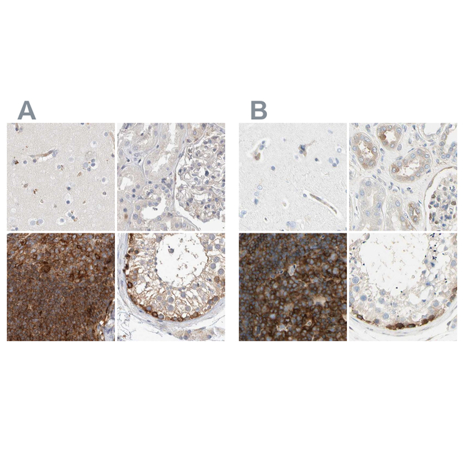 NFkB p100 Antibody in Immunohistochemistry (Paraffin) (IHC (P))