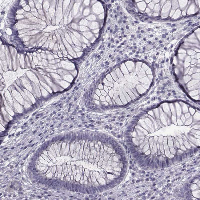 TTC25 Antibody in Immunohistochemistry (Paraffin) (IHC (P))