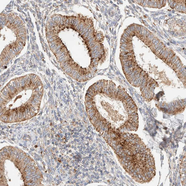 p40 Antibody in Immunohistochemistry (Paraffin) (IHC (P))