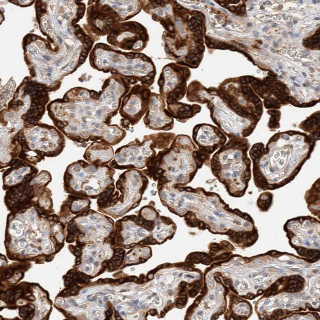 DEPDC6 Antibody in Immunohistochemistry (Paraffin) (IHC (P))