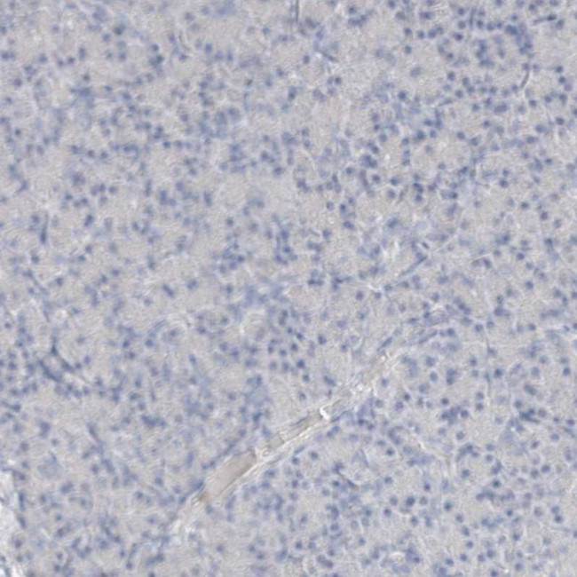 Arginase 1 Antibody in Immunohistochemistry (Paraffin) (IHC (P))