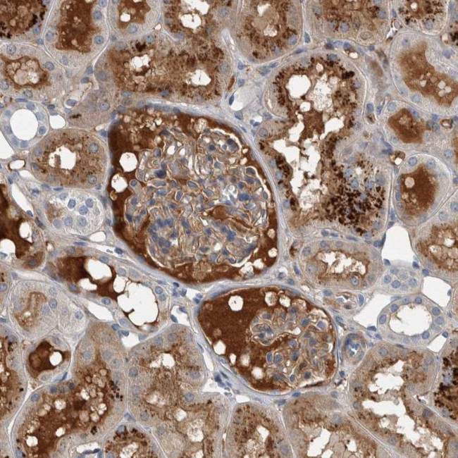 SERPINC1 Antibody in Immunohistochemistry (Paraffin) (IHC (P))
