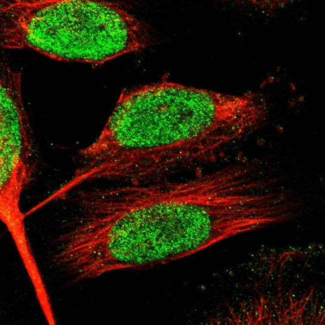 ZNF24 Antibody in Immunocytochemistry (ICC/IF)