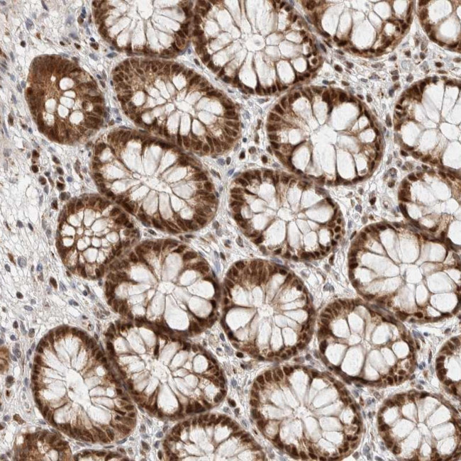 TSPAN32 Antibody in Immunohistochemistry (Paraffin) (IHC (P))