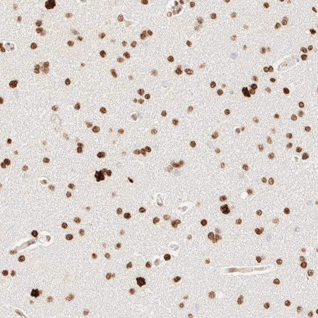 ZNF447 Antibody in Immunohistochemistry (Paraffin) (IHC (P))