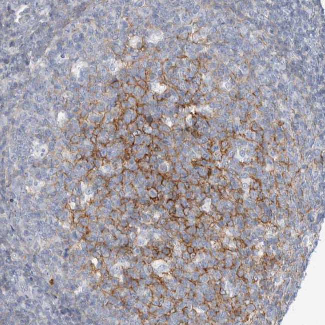 CD55 Antibody in Immunohistochemistry (Paraffin) (IHC (P))