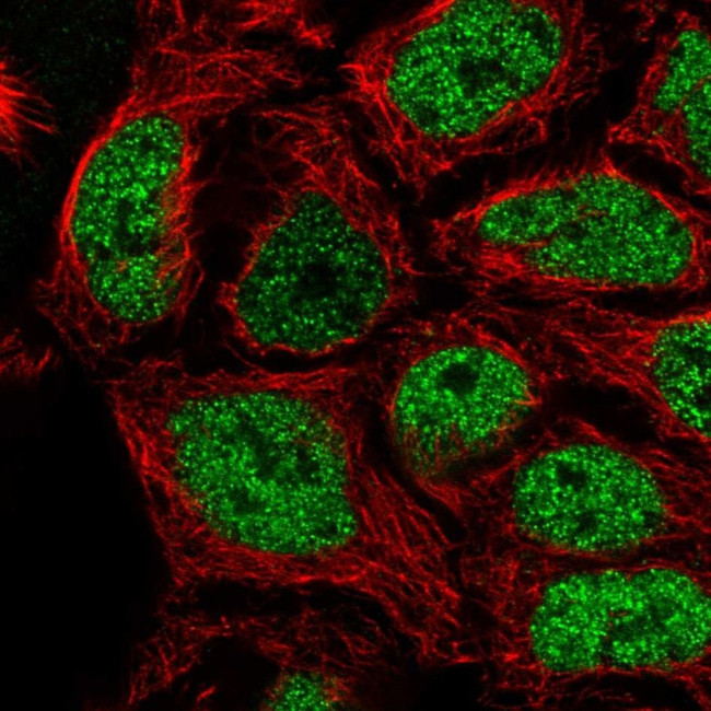 SP6 Antibody in Immunocytochemistry (ICC/IF)
