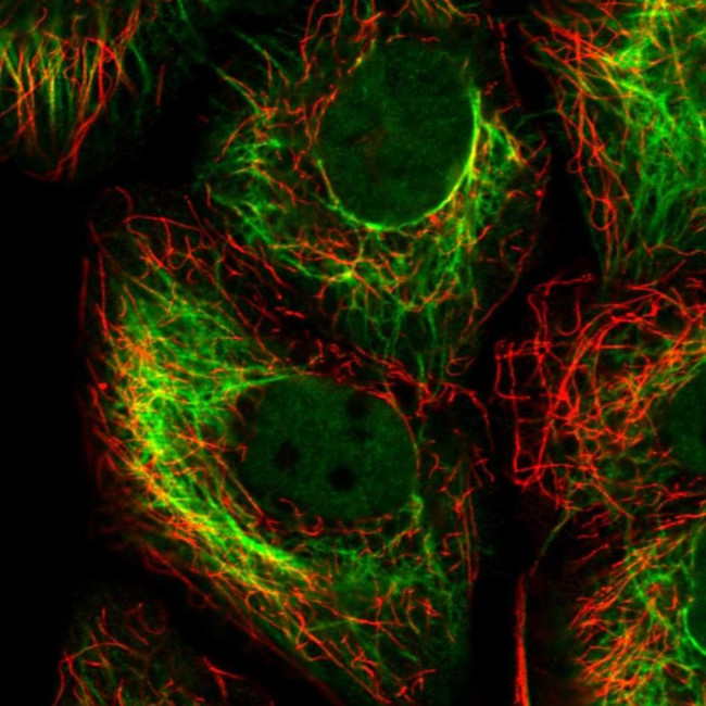Cytokeratin 15 Antibody in Immunocytochemistry (ICC/IF)