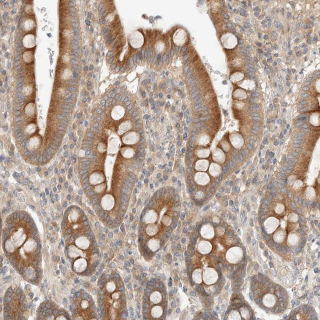 MARK3 Antibody in Immunohistochemistry (Paraffin) (IHC (P))