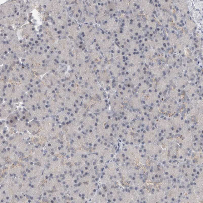 VPS28 Antibody in Immunohistochemistry (Paraffin) (IHC (P))