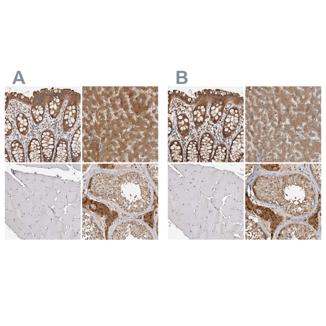ACAT2 Antibody in Immunohistochemistry (Paraffin) (IHC (P))