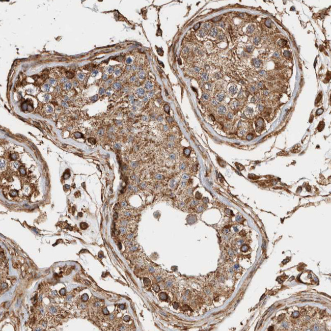 ZNF397 Antibody in Immunohistochemistry (Paraffin) (IHC (P))