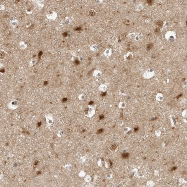PYK2 Antibody in Immunohistochemistry (Paraffin) (IHC (P))