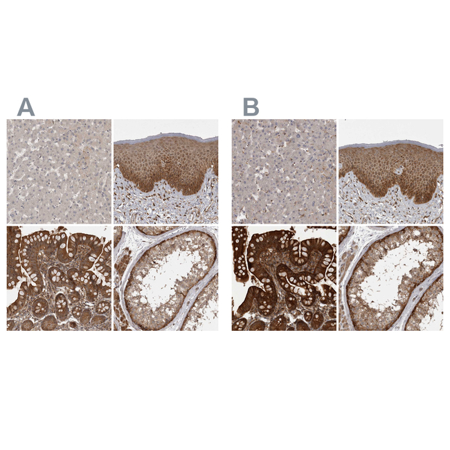 MST3 Antibody in Immunohistochemistry (Paraffin) (IHC (P))