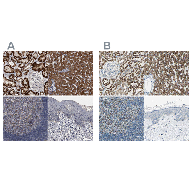 ACADM Antibody in Immunohistochemistry (Paraffin) (IHC (P))