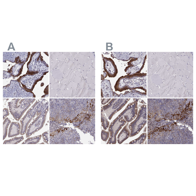 ERO1L Antibody in Immunohistochemistry (Paraffin) (IHC (P))