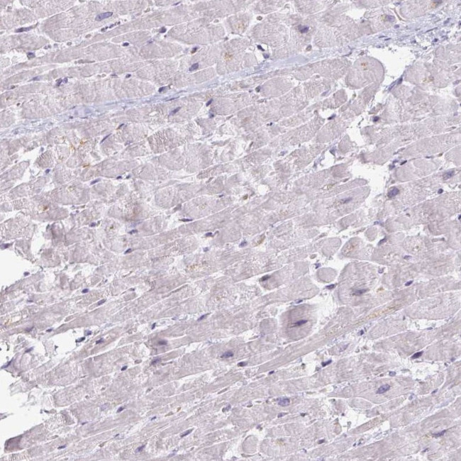 Carbonic Anhydrase III Antibody in Immunohistochemistry (Paraffin) (IHC (P))