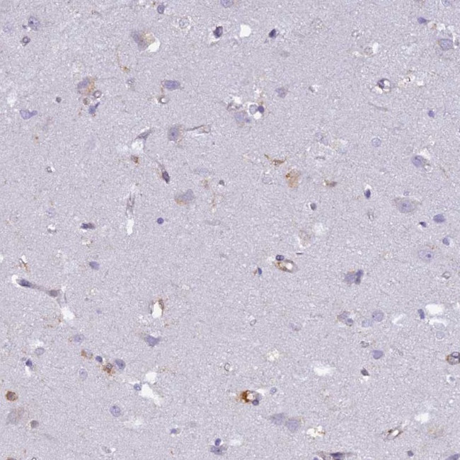 ADAP Antibody in Immunohistochemistry (Paraffin) (IHC (P))