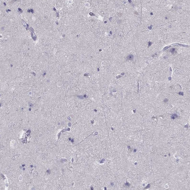 SPINT3 Antibody in Immunohistochemistry (Paraffin) (IHC (P))
