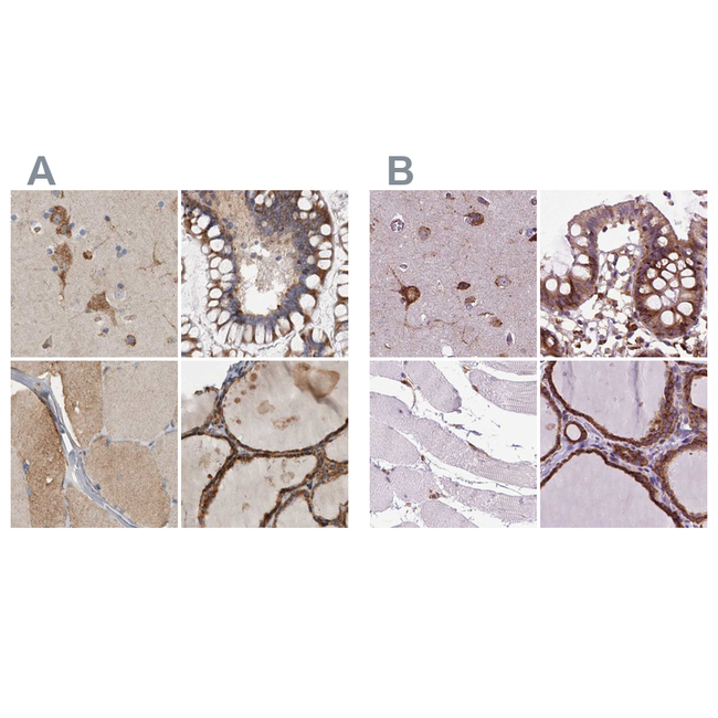 GANAB Antibody in Immunohistochemistry (Paraffin) (IHC (P))