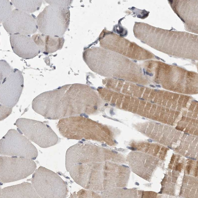 MAN2A1 Antibody in Immunohistochemistry (Paraffin) (IHC (P))