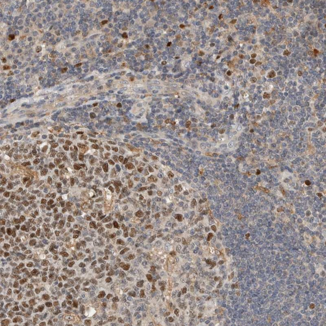 CK1 gamma-3 Antibody in Immunohistochemistry (Paraffin) (IHC (P))