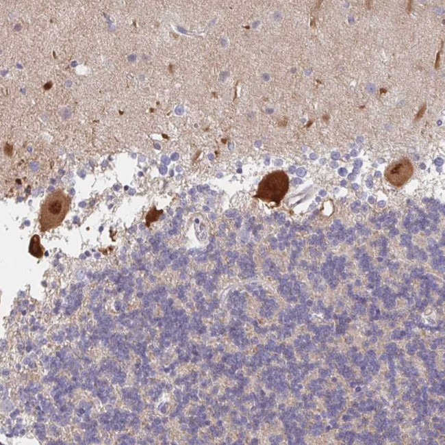 AMPD2 Antibody in Immunohistochemistry (Paraffin) (IHC (P))