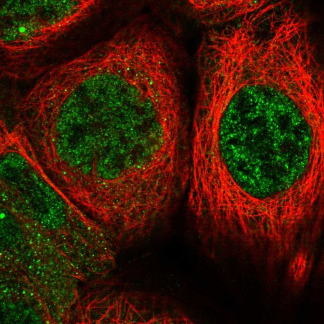 PDCD4 Antibody in Immunocytochemistry (ICC/IF)