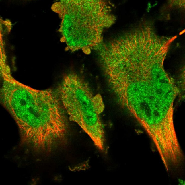 DYRK2 Antibody in Immunocytochemistry (ICC/IF)