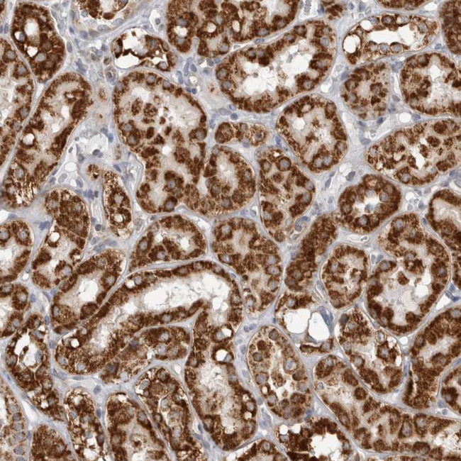 Fumarase Antibody in Immunohistochemistry (Paraffin) (IHC (P))