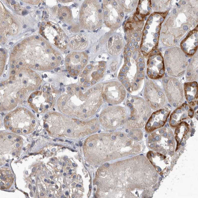 PDK1 Antibody in Immunohistochemistry (Paraffin) (IHC (P))