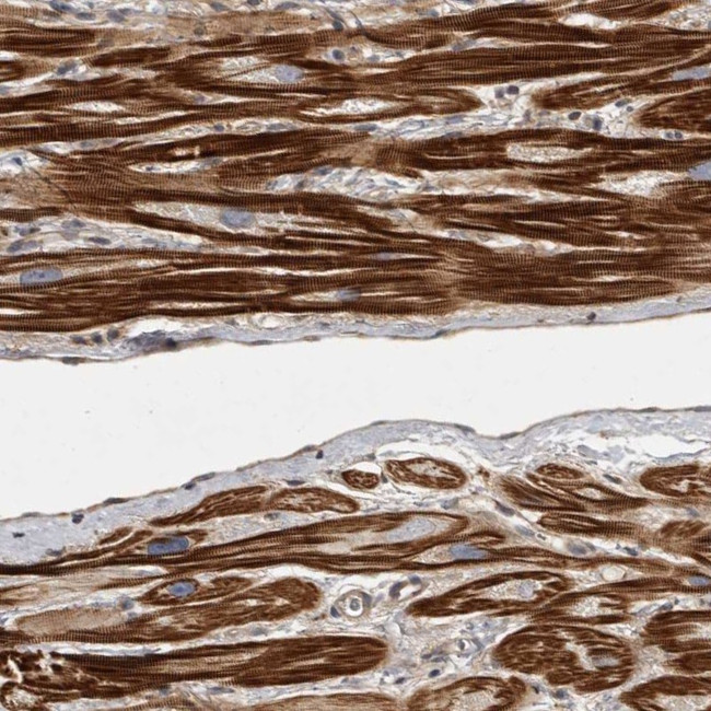 ORP9 Antibody in Immunohistochemistry (Paraffin) (IHC (P))