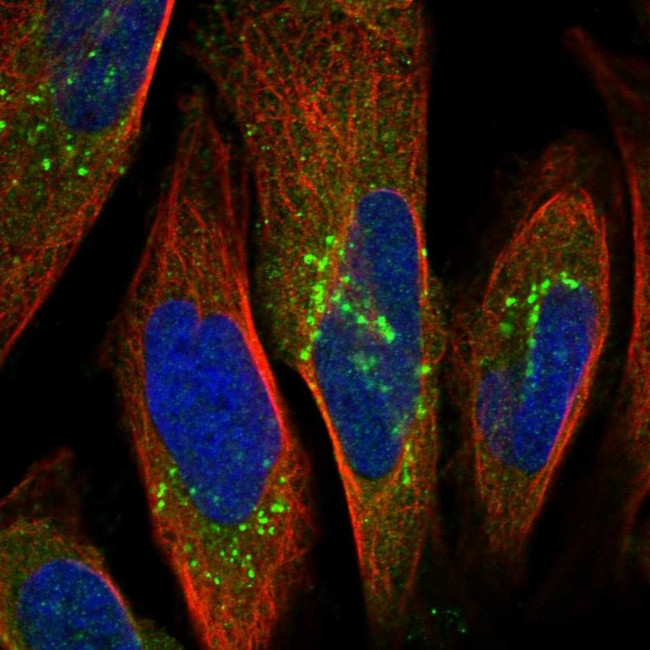 ORP9 Antibody in Immunocytochemistry (ICC/IF)