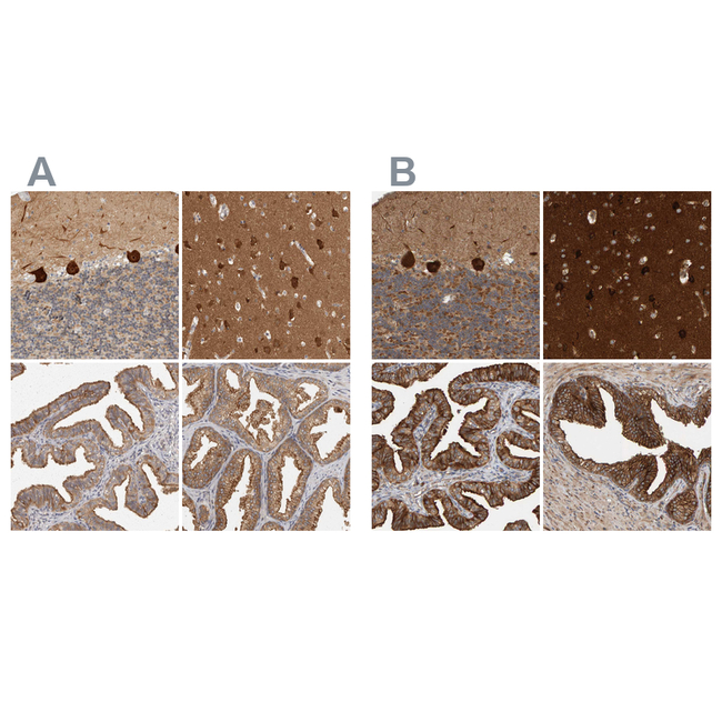 BAIAP2 Antibody in Immunohistochemistry (Paraffin) (IHC (P))
