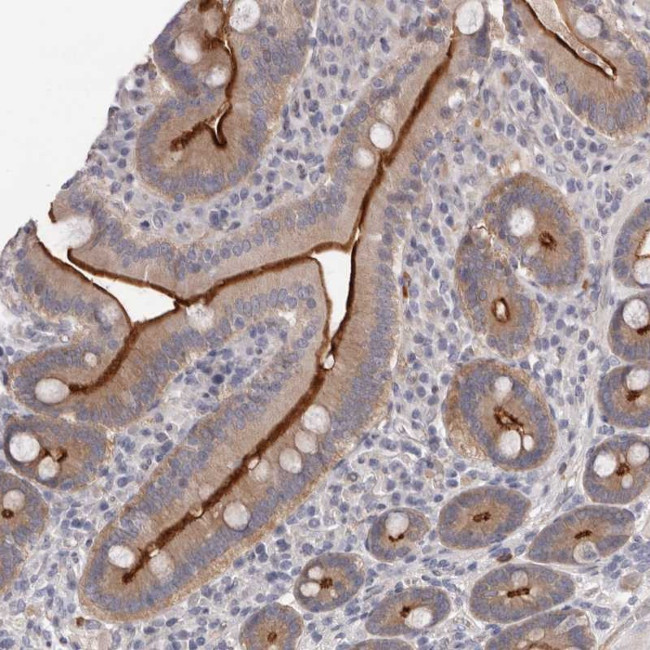 USH1C Antibody in Immunohistochemistry (Paraffin) (IHC (P))