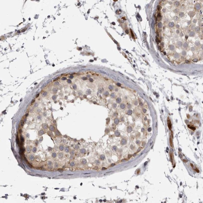 EphA10 Antibody in Immunohistochemistry (Paraffin) (IHC (P))