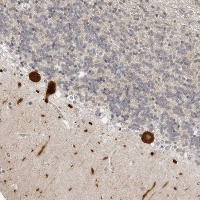PPP2R5C Antibody in Immunohistochemistry (Paraffin) (IHC (P))