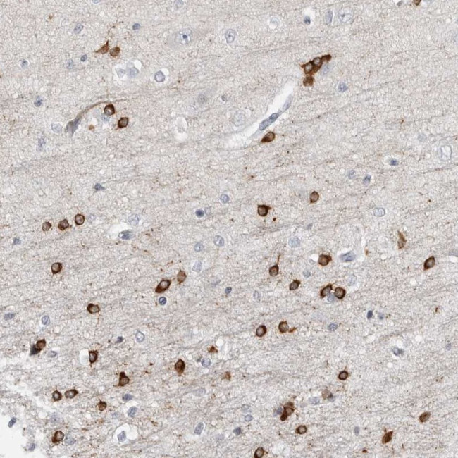 HIPK4 Antibody in Immunohistochemistry (Paraffin) (IHC (P))