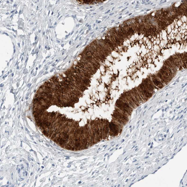 SLPI Antibody in Immunohistochemistry (Paraffin) (IHC (P))