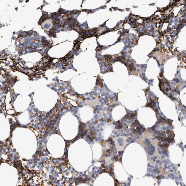 Spectrin alpha-1 Antibody in Immunohistochemistry (Paraffin) (IHC (P))