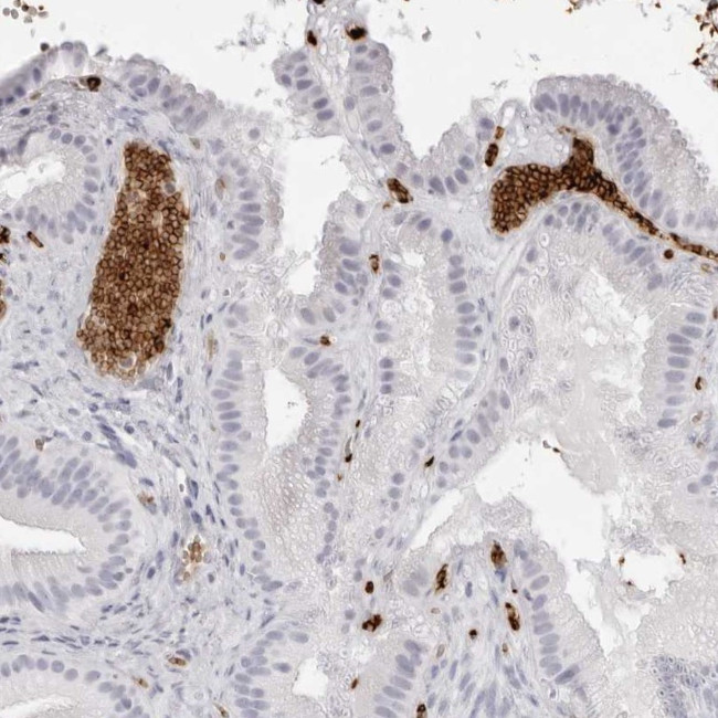 Spectrin alpha-1 Antibody in Immunohistochemistry (Paraffin) (IHC (P))